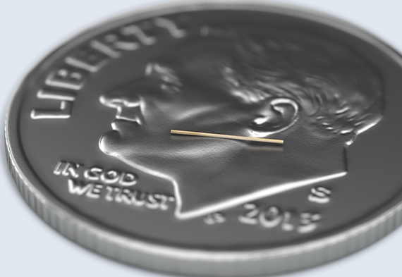 Treating glaucoma and cataract at the same time