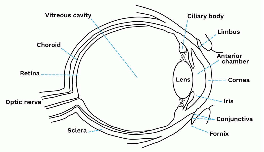 Cataract Diagram