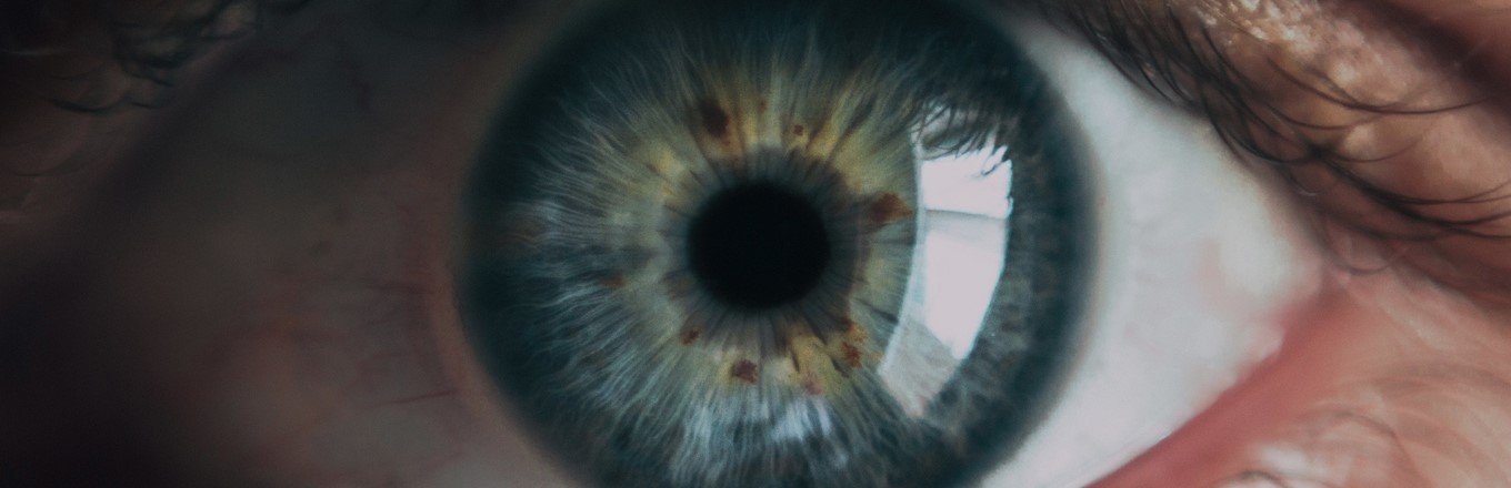 What Is The Aftercare Following Cataract Surgery