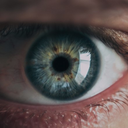 CATARACT