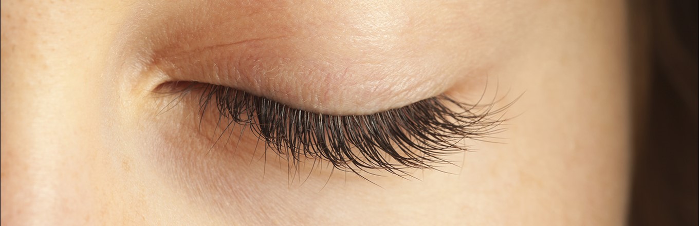 Blepharitis and Evaporative Dry Eye