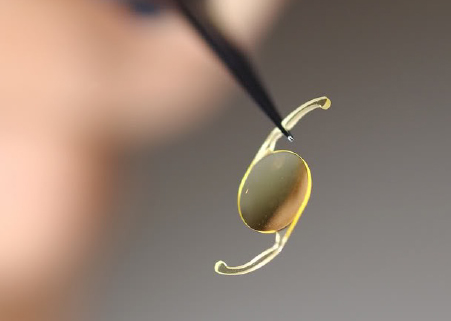 New Horizons in Cataract Surgery