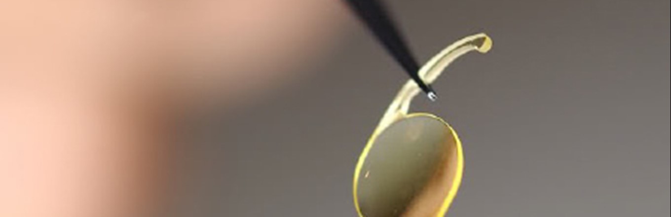 New Horizons in Cataract Surgery