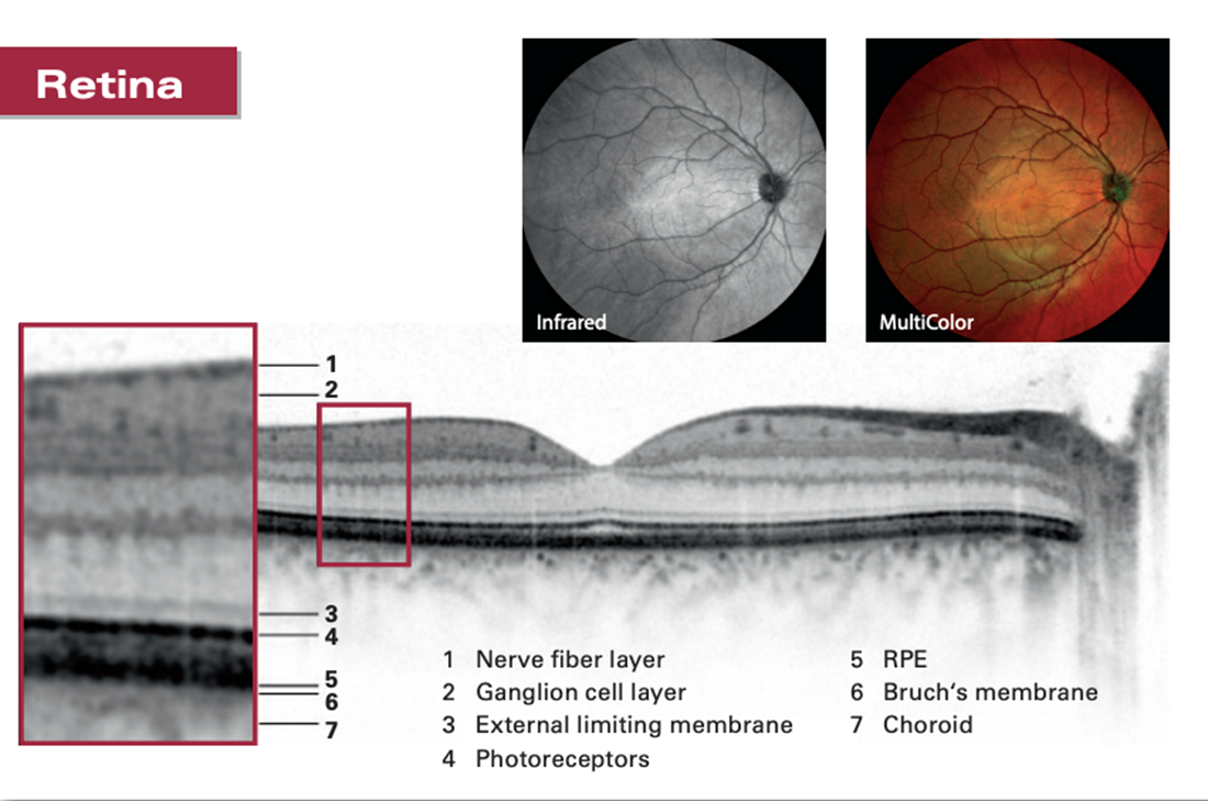 Retina OCT